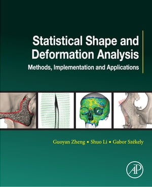 Statistical Shape and Deformation Analysis