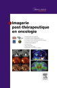 Imagerie post-th rapeutique en oncologie【電子書籍】 Soci t Fran aise de Radiologie