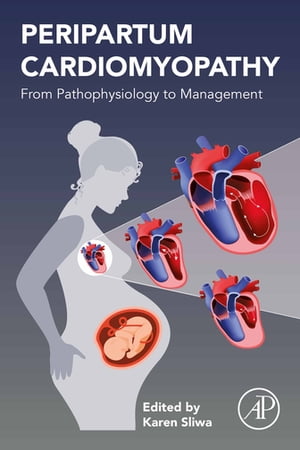 Peripartum Cardiomyopathy From Pathophysiology to Management【電子書籍】