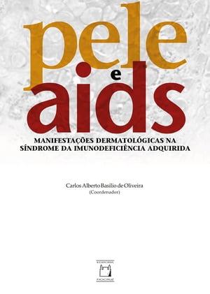 Pele e Aids