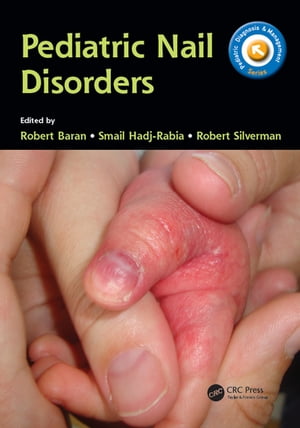 Pediatric Nail Disorders【電子書籍】
