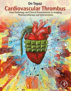 Cardiovascular Thrombus From Pathology and Clinical Presentations to Imaging, Pharmacotherapy and Interventions【電子書籍】