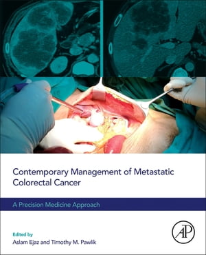 Contemporary Management of Metastatic Colorectal Cancer A Precision Medicine Approach