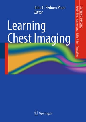 Learning Chest Imaging【電子書籍】