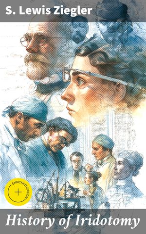 History of Iridotomy Enriched edition. Knife-Needle vs. ScissorsーDescription of Author's V-Shap..