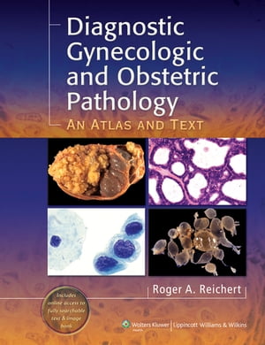 Diagnostic Gynecologic and Obstetric Pathology An Atlas and Text【電子書籍】 Roger A. Reichert