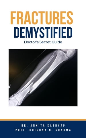 Fractures Demystified: Doctor’s Secret Guide