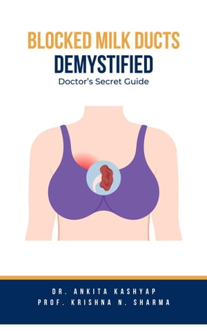 Blocked Milk Ducts Demystified: Doctor’s Secret Guide