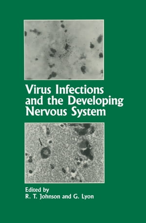 Virus Infections and the Developing Nervous System