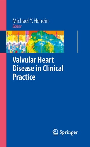 ŷKoboŻҽҥȥ㤨Valvular Heart Disease in Clinical PracticeŻҽҡۡפβǤʤ6,076ߤˤʤޤ