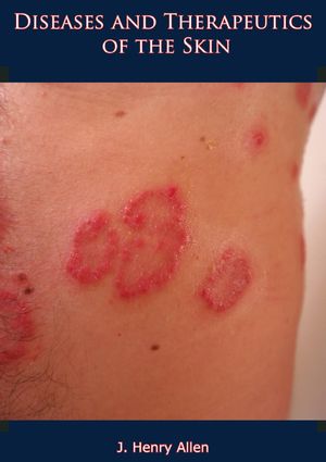 ŷKoboŻҽҥȥ㤨Diseases and Therapeutics of the SkinŻҽҡ[ J. Henry Allen ]פβǤʤ442ߤˤʤޤ