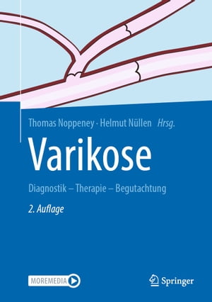 Varikose