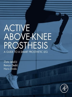 Active Above-Knee Prosthesis A Guide to a Smart Prosthetic Leg