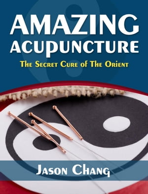 Amazing Acupuncture The Secret Cure of The Orient【電子書籍】[ Jason Chang ]