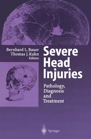 Severe Head Injuries Pathology, Diagnosis and Treatment【電子書籍】