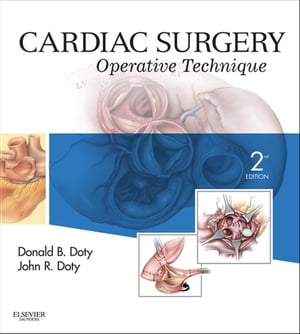 Cardiac Surgery E-Book Operative and Evolving TechniqueŻҽҡ[ Donald B. Doty, MD ]