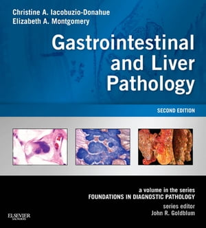 Gastrointestinal and Liver Pathology E-Book A Volume in the Series: Foundations in Diagnostic Pathology【電子書籍】 Christine A. Iacobuzio-Donahue, MD, PhD