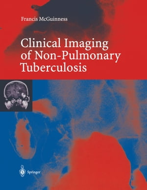 Clinical Imaging in Non-Pulmonary Tuberculosis