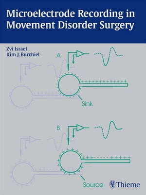 Microelectrode Recording in Movement Disorder Surgery【電子書籍】