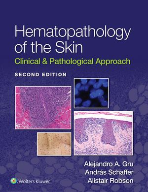 Hematopathology of the Skin Clinical Pathological Approach【電子書籍】 Alejandro A. Gru
