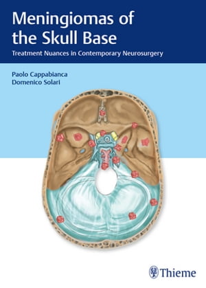 Meningiomas of the Skull Base