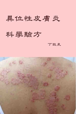 異位性皮膚炎的科學驗方【電子書籍】[ 丁致良 ]