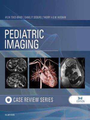 Pediatric Imaging: Case Review E-Book【電子書籍】[ Aylin Tekes-Brady ]