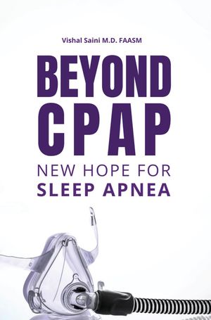 ŷKoboŻҽҥȥ㤨Beyond CPAP New hope for sleep APNEAŻҽҡ[ Vishal Saini ]פβǤʤ691ߤˤʤޤ
