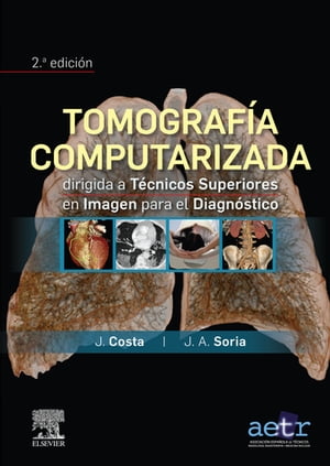 Tomograf?a computarizada dirigida a t?cnicos superiores en imagen para el diagn?stico【電子書籍】[ Joaqu?n Costa Subias ]