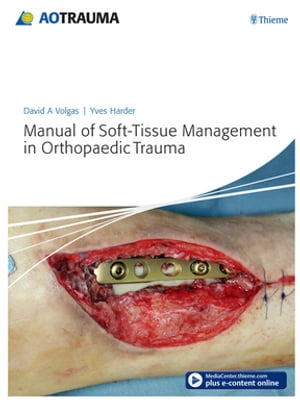 Manual of Soft-Tissue Management in Orthopaedic Trauma【電子書籍】 David A. Volgas