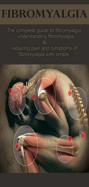 Fibromyalgia The complete guide to fibromyalgia, understanding fibromyalgia, and reducing pain and symptoms of fibromyalgia with simple treatment methods!