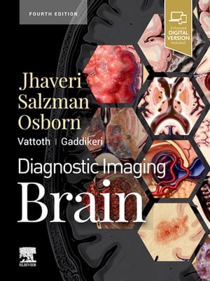 Diagnostic Imaging: Brain