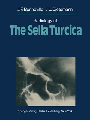 Radiology of The Sella Turcica【電子書籍】[ J. Metzger ]