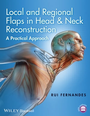 Local and Regional Flaps in Head and Neck Reconstruction A Practical ApproachŻҽҡ[ Rui Fernandes ]