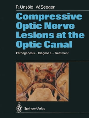 Compressive Optic Nerve Lesions at the Optic Canal