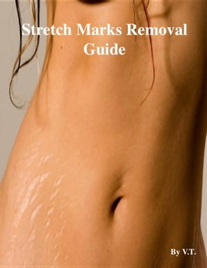 Stretch Marks Removal Guide