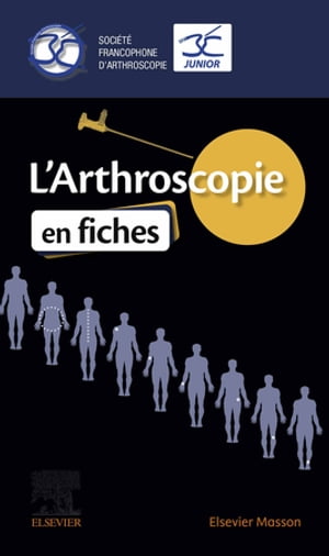 L'Arthroscopie en fiches