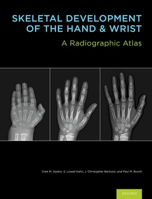 Skeletal Development of the Hand and Wrist A Radiographic Atlas and Digital Bone Age Companion
