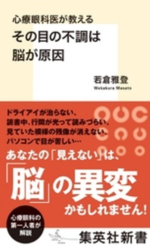 心療眼科医が教える　その目の不調は脳が原因