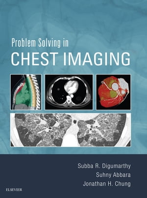 Problem Solving in Chest Imaging E-Book
