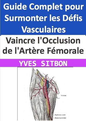 Vaincre l'Occlusion de l'Artère Fémorale : Guide Complet pour Surmonter les Défis Vasculaires