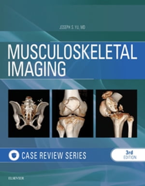 Musculoskeletal Imaging: Case Review Series E-Book