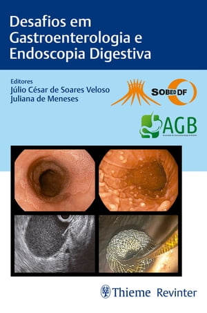 Desafios em Gastroenterologia e Endoscopia Digestiva