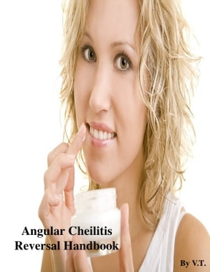 Angular Cheilitis Reversal Handbook