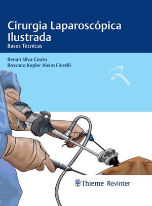 Cirurgia Laparoscópica Ilustrada