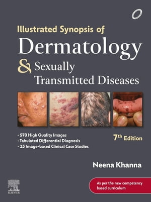 Illustrated Synopsis of Dermatology & Sexually Transmitted Diseases - E-Book