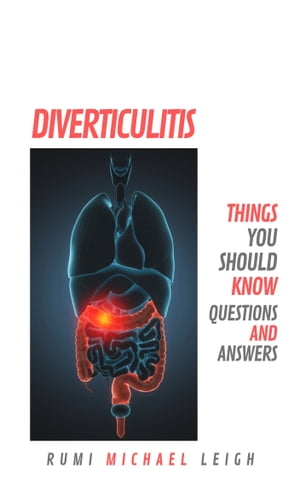 Diverticulitis