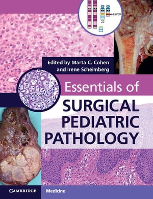 ŷKoboŻҽҥȥ㤨Essentials of Surgical Pediatric PathologyŻҽҡۡפβǤʤ29,306ߤˤʤޤ