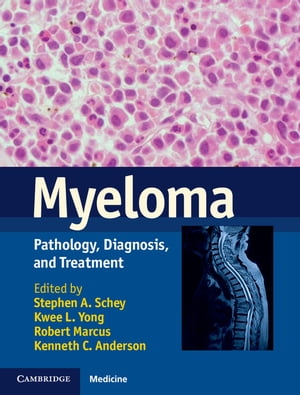 Myeloma Pathology, Diagnosis, and Treatment【電子書籍】