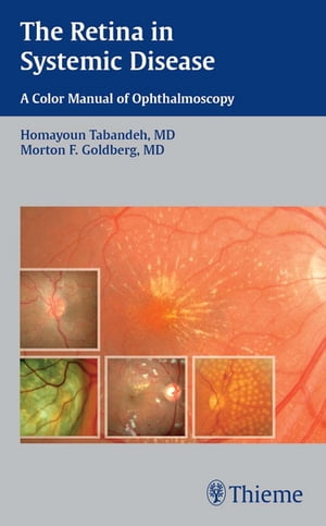 The Retina in Systemic Disease